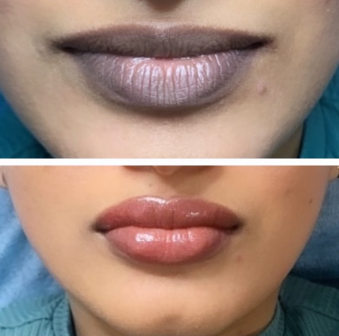 LIP BLUSH: DARK LIP CORRECTION